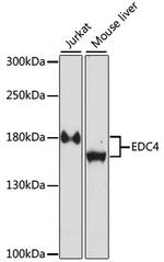 EDC4 Polyclonal Antibody