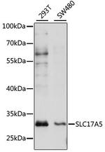 SLC17A5 Polyclonal Antibody