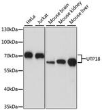 UTP18 Polyclonal Antibody