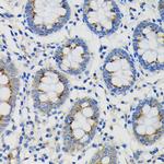 SDF4 Antibody in Immunohistochemistry (Paraffin) (IHC (P))