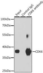 CDK6 Antibody in Immunoprecipitation (IP)