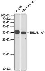 TRSPAP1 Polyclonal Antibody