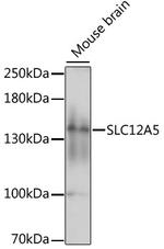 KCC2 Polyclonal Antibody