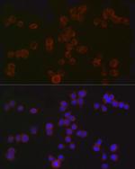 CD4 Antibody in Immunocytochemistry (ICC/IF)
