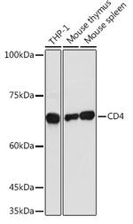 CD4 Antibody in Western Blot (WB)