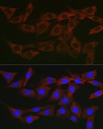 WNK3 Polyclonal Antibody