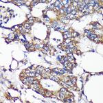 SLIRP Polyclonal Antibody