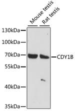 CDY1B Polyclonal Antibody