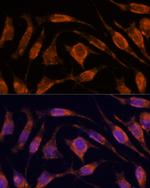 Importin 4 Polyclonal Antibody