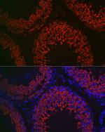 DDX4 Antibody in Immunohistochemistry (Paraffin) (IHC (P))