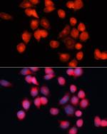 SLC25A5 Polyclonal Antibody