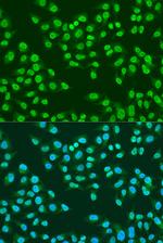 ATM Antibody in Immunocytochemistry (ICC/IF)