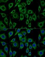 TSPO Polyclonal Antibody