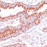 ENTPD6 Polyclonal Antibody