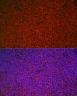 ETS1 Antibody in Immunocytochemistry (ICC/IF)