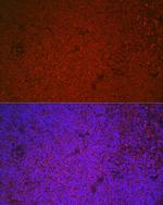 ETS1 Polyclonal Antibody
