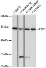 ETV6 Polyclonal Antibody