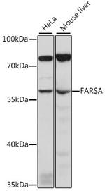 FARSA Polyclonal Antibody