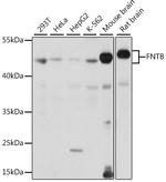 FNTB Polyclonal Antibody