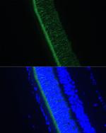 GNGT1 Antibody in Immunohistochemistry (Paraffin) (IHC (P))