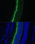 GNGT1 Polyclonal Antibody