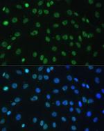hnRNP D Antibody in Immunocytochemistry (ICC/IF)