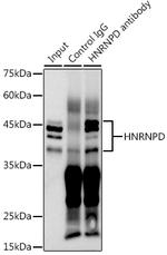 hnRNP D Antibody in Immunoprecipitation (IP)