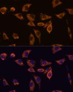 IL10RB Polyclonal Antibody