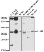 IL10RB Antibody in Western Blot (WB)