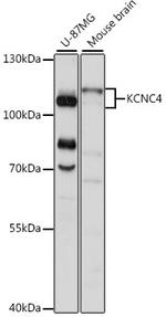 KV3.4 (KCNC4) Polyclonal Antibody