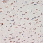 Neuroserpin Polyclonal Antibody