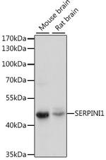 Neuroserpin Antibody in Western Blot (WB)