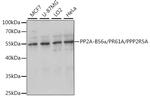 PPP2R5A Antibody in Western Blot (WB)