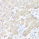 Haptoglobin Polyclonal Antibody