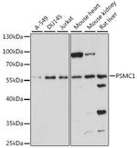 PSMC1 Polyclonal Antibody