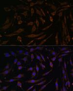 RSK1 Antibody in Immunocytochemistry (ICC/IF)