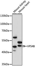 VPS4B Polyclonal Antibody