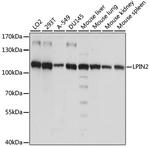 LPIN2 Polyclonal Antibody