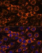 ACAA2 Antibody in Immunocytochemistry (ICC/IF)