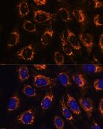 ACAA2 Polyclonal Antibody
