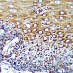 SPECC1L Polyclonal Antibody