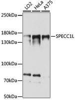 SPECC1L Antibody in Western Blot (WB)