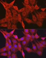 Galectin 1 Antibody in Immunocytochemistry (ICC/IF)