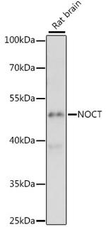 CCRN4L Antibody in Western Blot (WB)