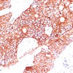 FAM98A Antibody in Immunohistochemistry (Paraffin) (IHC (P))