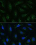 COPG2 Polyclonal Antibody