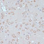 COPG2 Antibody in Immunohistochemistry (Paraffin) (IHC (P))