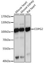 COPG2 Antibody in Western Blot (WB)
