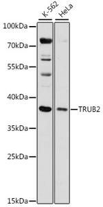 TRUB2 Polyclonal Antibody