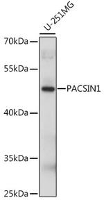 PACSIN1 Antibody in Western Blot (WB)